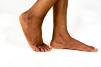 Types and Causes of Flat Feet